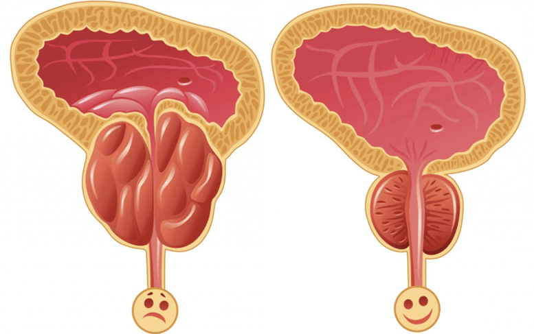 cúiseanna fadhbanna potency i fir